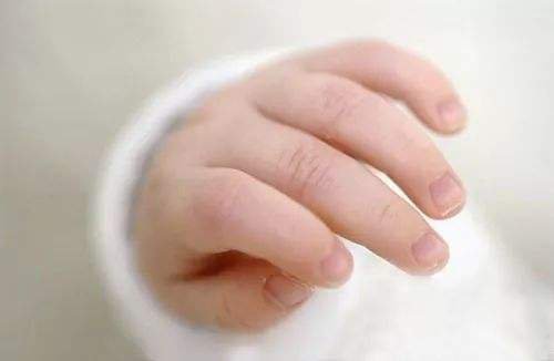 指甲有这5种症状 说明宝宝可能患病(图1)